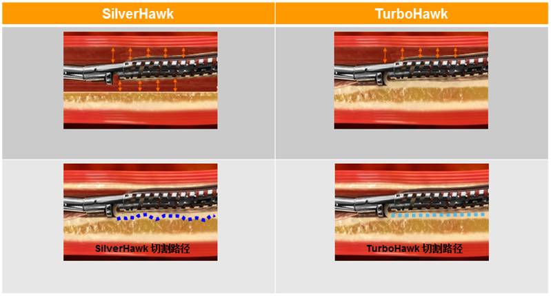 TurboHawk